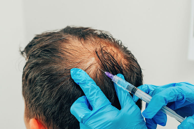 MESOTHERAPY-MEN